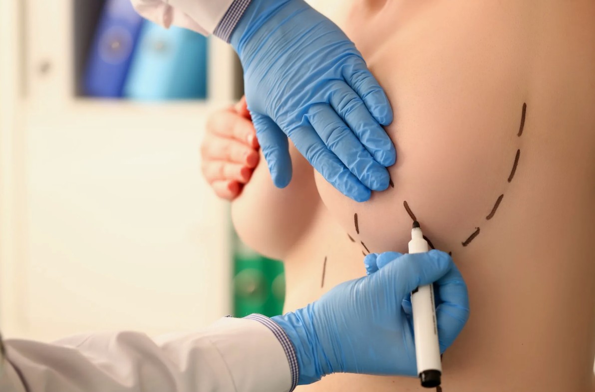 Аугментационная маммопластика